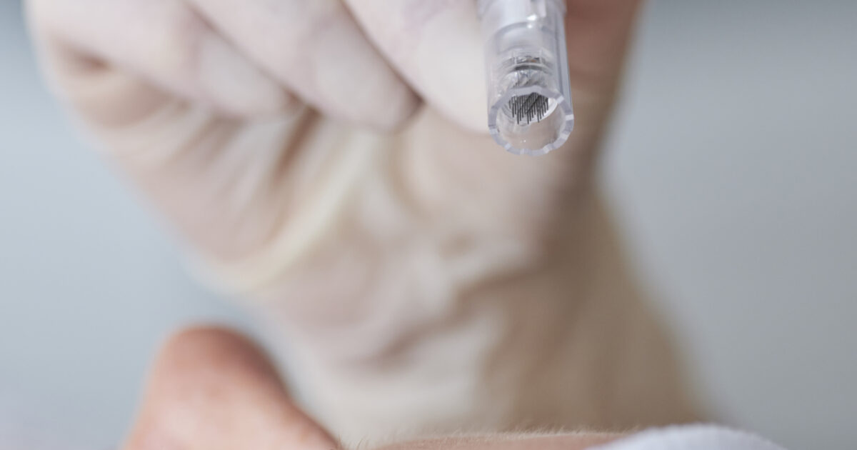 Microneedling with Collagen P.I.N. | Woodford Medical