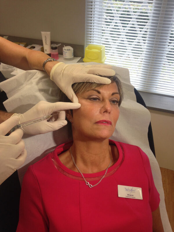 Sharon receiving Juvederm Voluma