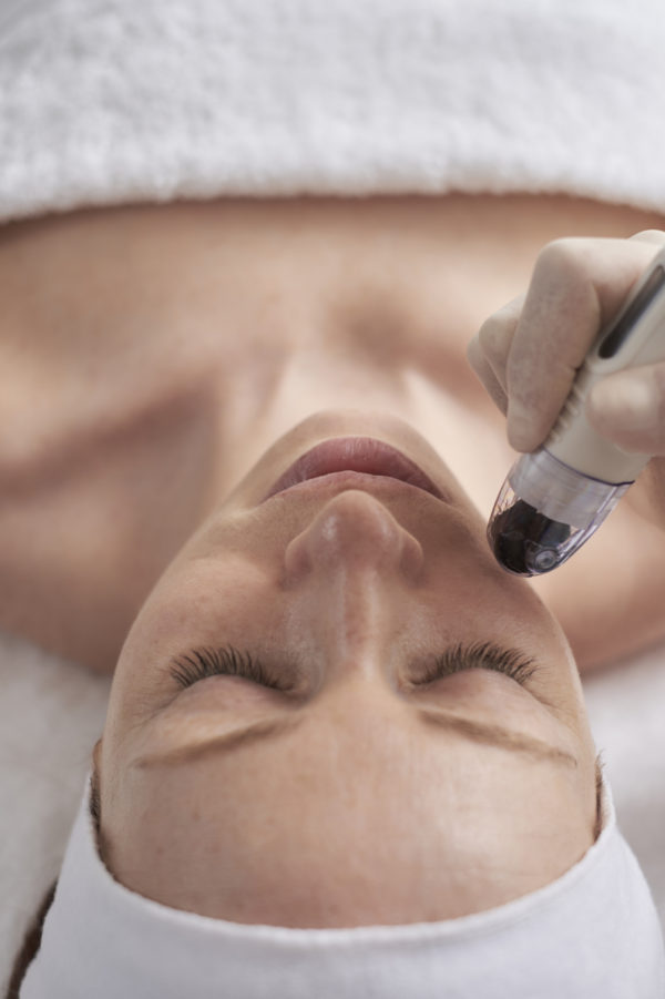 Lady receiving DermaFrac treatment