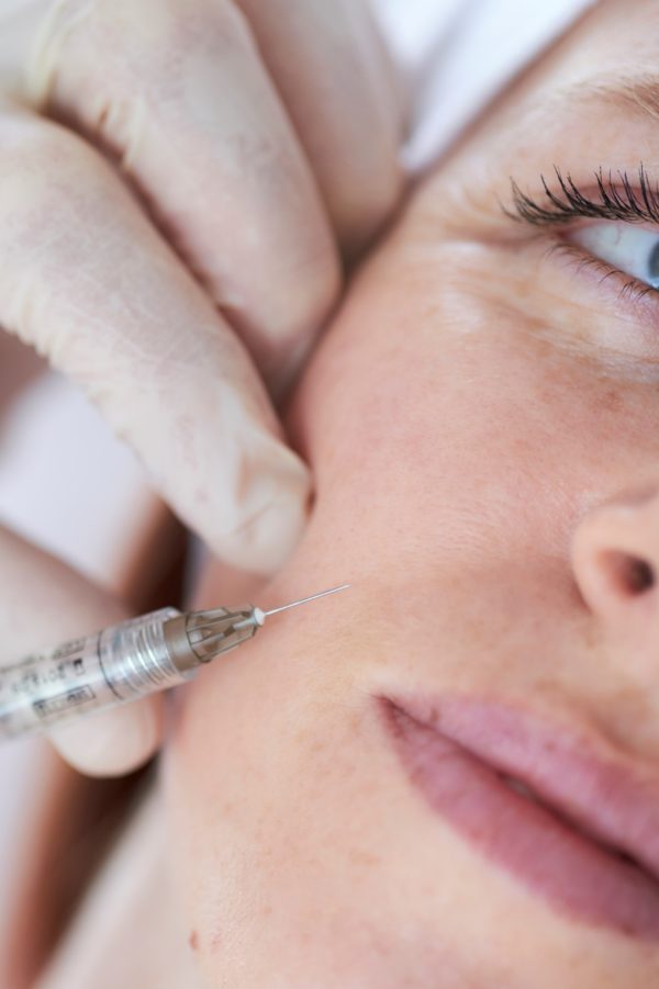 Profhilo treatment