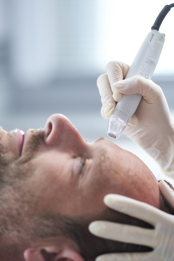 DermaFrac treatment