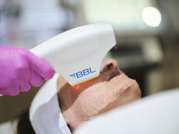 BBL Moxi Laser