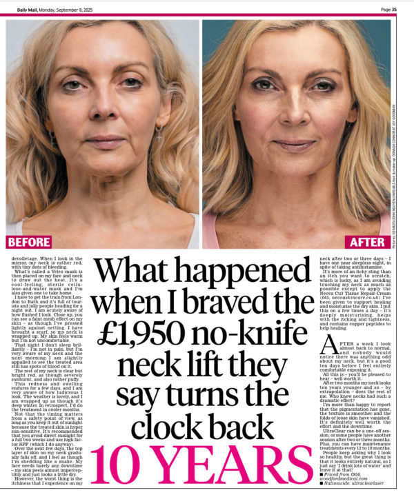Daily Mail Ultra Clear Neck Lift at Woodford Medical Pt2