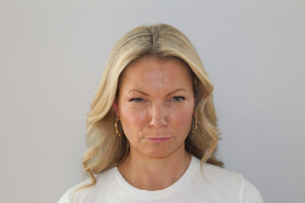 Botox after