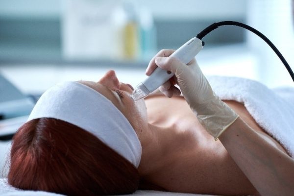 Microdermabrasion