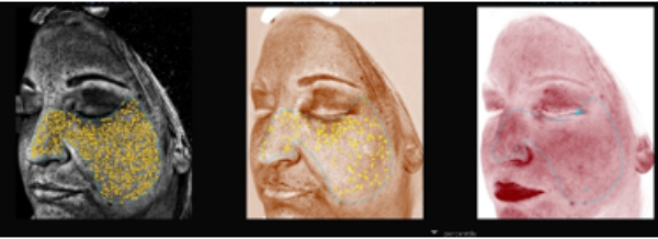 Visia at Woodford Medical