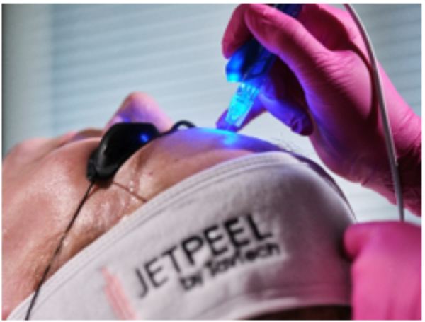 Jetpeel at woodford medical