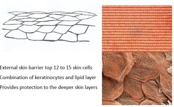 External skin barrier