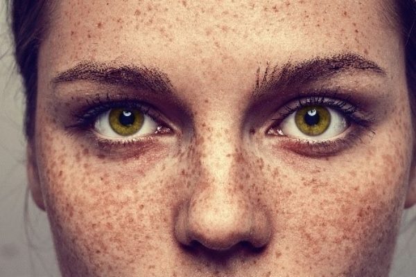 Pigmentation