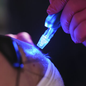 Why JetPeel is the Ultimate  Summer Skin Reset