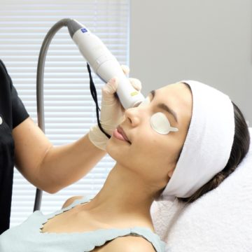 Laser Skin Resurfacing