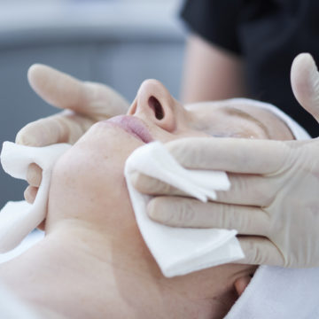 Skin Peels