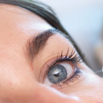 Cosmetic Eyelid Surgery (Blepharoplasty)
