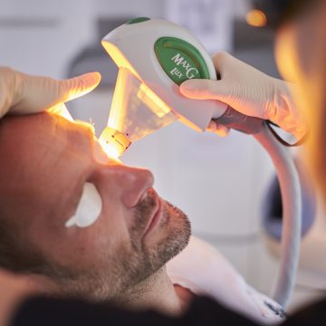 IPL Photorejuvenation