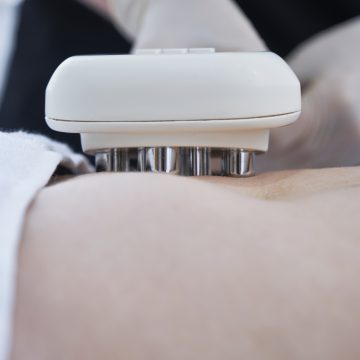 Radiofrequency 4PLUS Skin Tightening for Face And Body