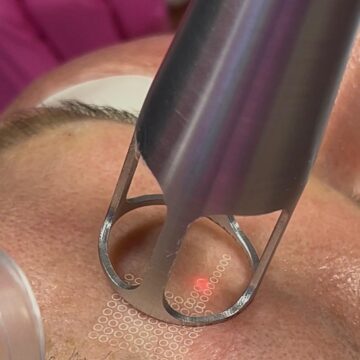 UltraClear 3DMIRACL®