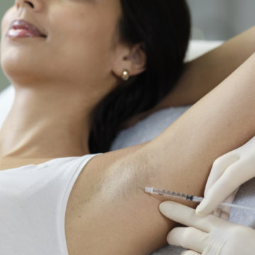 Botox® For Sweating