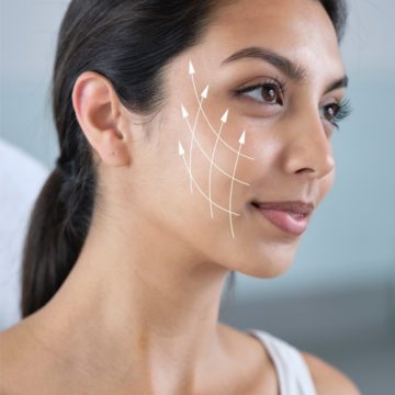 PDO Threads: The Non-Surgical Lift You Need!