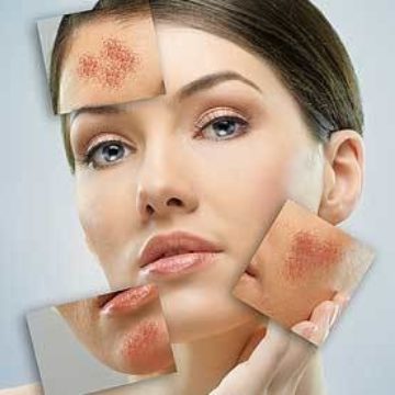 Is Tretinoin safe for long term use in skin ageing?