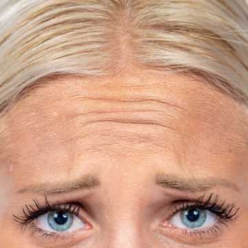 Lines And Wrinkles