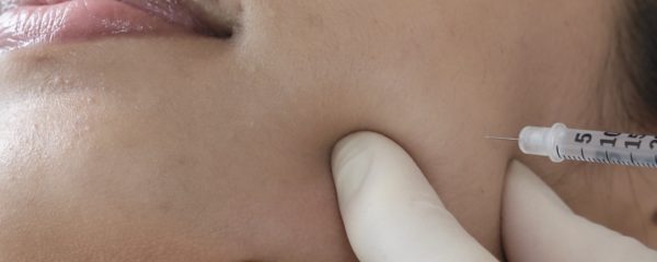 Botox Injections for Bruxism and teeth grinding